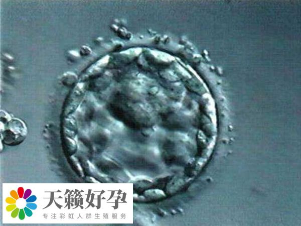 試管嬰兒優(yōu)胚的成功率比較高