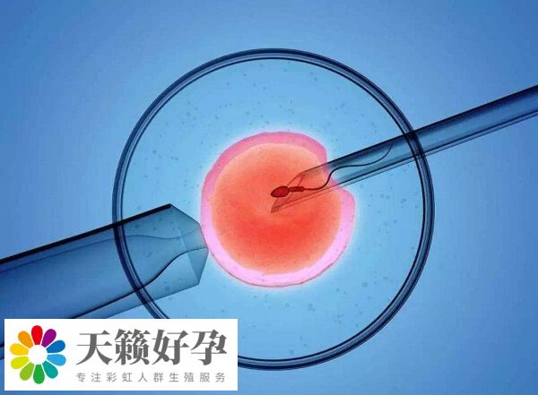 只有符合條件的患者才可以做試管嬰兒