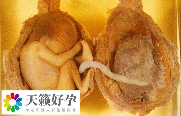 海南醫學院第一附屬醫院擁有選擇性減胎技術