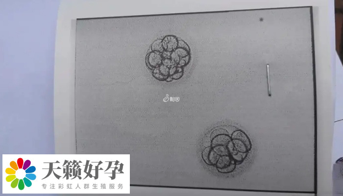 移植凍胚和自然懷孕測出的時間有無差距
