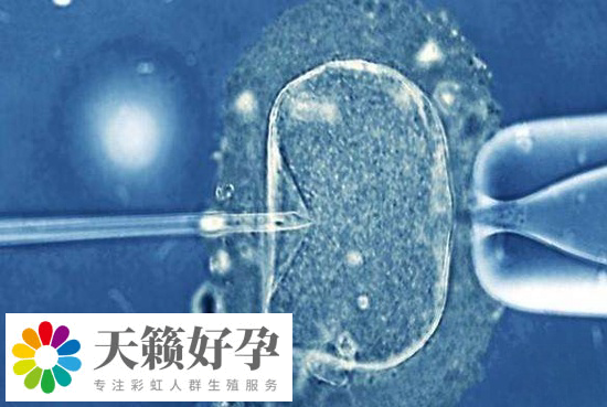 大齡能否赴泰國做試管移植