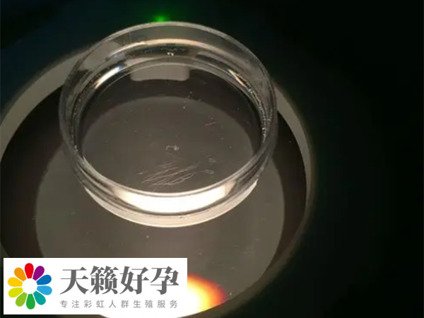 申請供精是否要檢查顯微鏡