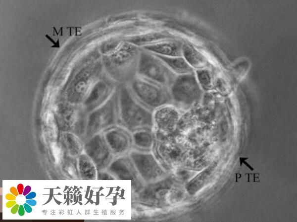 做試管培養囊胚的好處盤點，提高著床率、降低風險你得知