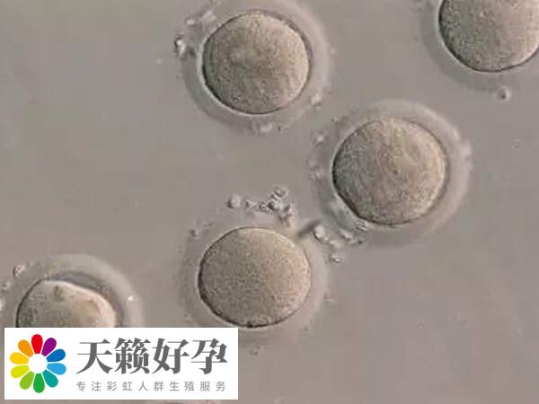 哪些情況不能移植鮮胚