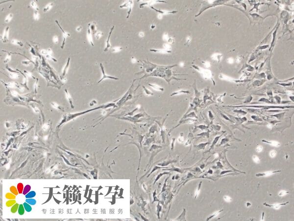 女女同性戀能用骨髓干細胞生孩子嗎？成功率高不高？